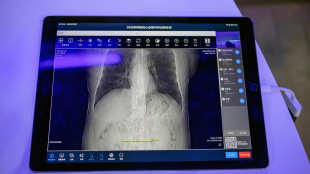 Gimbe, 'raggiunti target Pnrr su digitalizzazione, ma manca trasparenza'