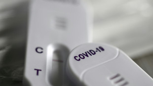 Covid long: marginale, la piste psychologique reste port&eacute;e par certains chercheurs