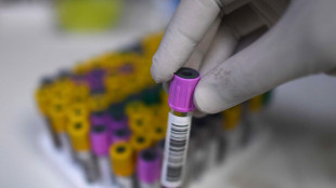 Tubercolosi, verso test sangue ultra-sensibile per diagnosi infezione latente o iniziale